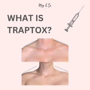 Traptox botox infographic part one